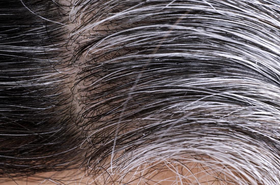 wellhealthorganic.com/know-the-causes-of-white-hair-and-easy-ways-to-prevent-it-naturally